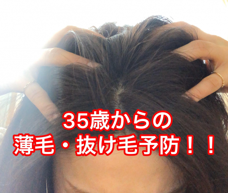 35歳からの女性のお悩み 薄毛 抜け毛予防 抜け毛 35歳からの女性のお悩み 薄毛 抜け毛予防 抜け毛